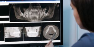 Dental Implant Case Study: Product Engineering